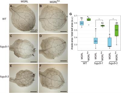 Lack of Vacuolar H+ -Pyrophosphatase and Cytosolic Pyrophosphatases Causes Fatal Developmental Defects in Arabidopsis thaliana